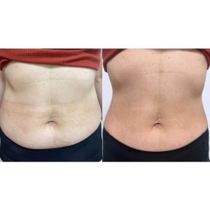 ダイエット ※若よもぎ蒸し協会　盗用禁止