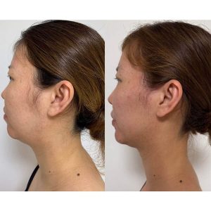 肌荒れ ※若よもぎ蒸し協会　盗用禁止