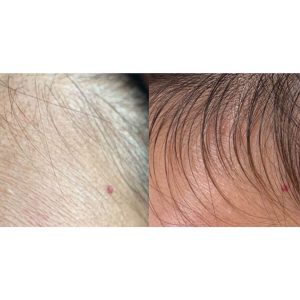 育毛 ※若よもぎ蒸し協会　盗用禁止