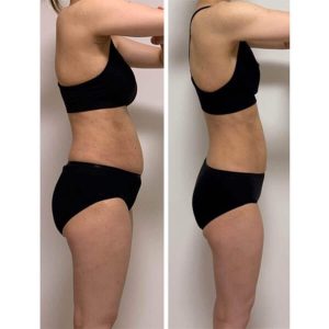 ダイエット ※若よもぎ蒸し協会　盗用禁止