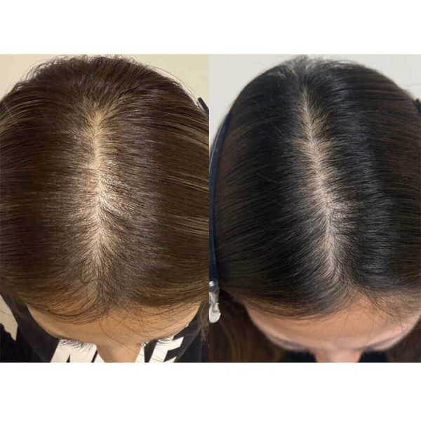 育毛 ※若よもぎ蒸し協会　盗用禁止